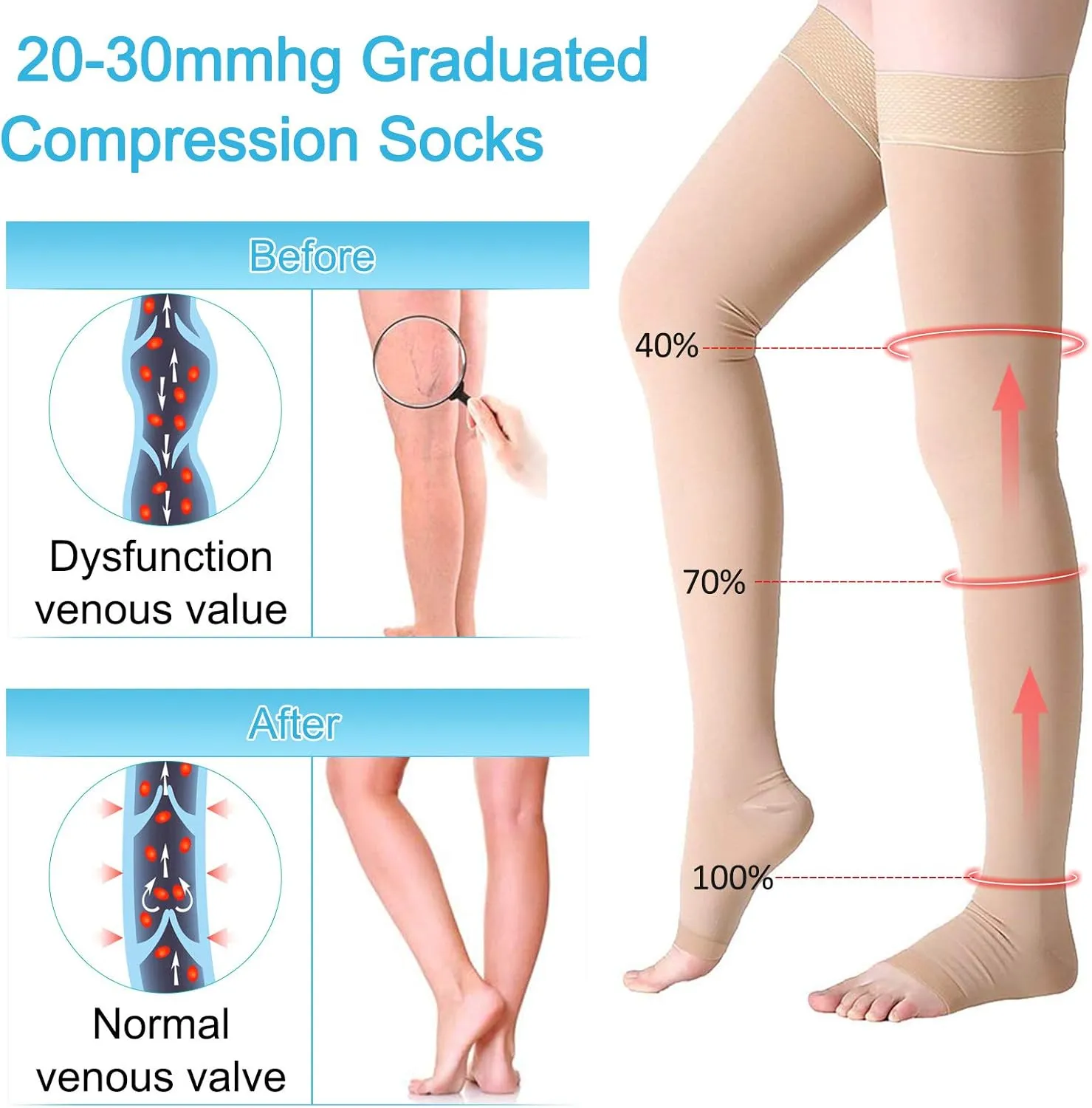 Compression Stockings Thigh High for Women Men 20-30 mmhg Graduated Compression Socks Open Toe Compression Support Hose with Non-Slide Silicone Dot Band for Swelling and Varicose Veins (Beige,S)